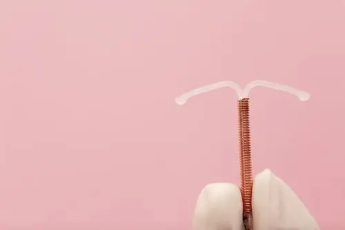 Interesse por DIU como método contraceptivo aumenta 105% no Brasil nos últimos 5 anos