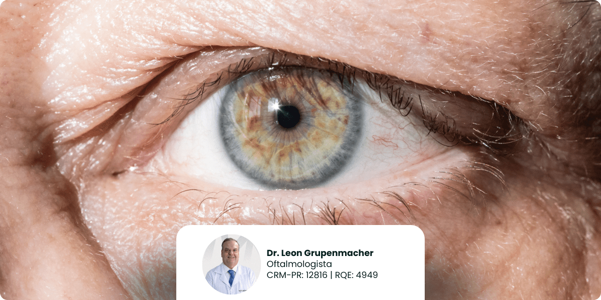 Blefaroplastia: cuidado direto com a saúde ocular