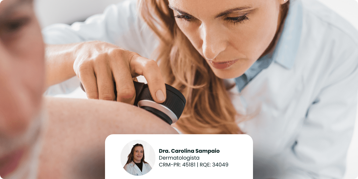 Câncer de pele: o perigo invisível do sol