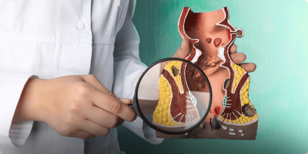 Colonoscopia é prevenção: descubra por quê