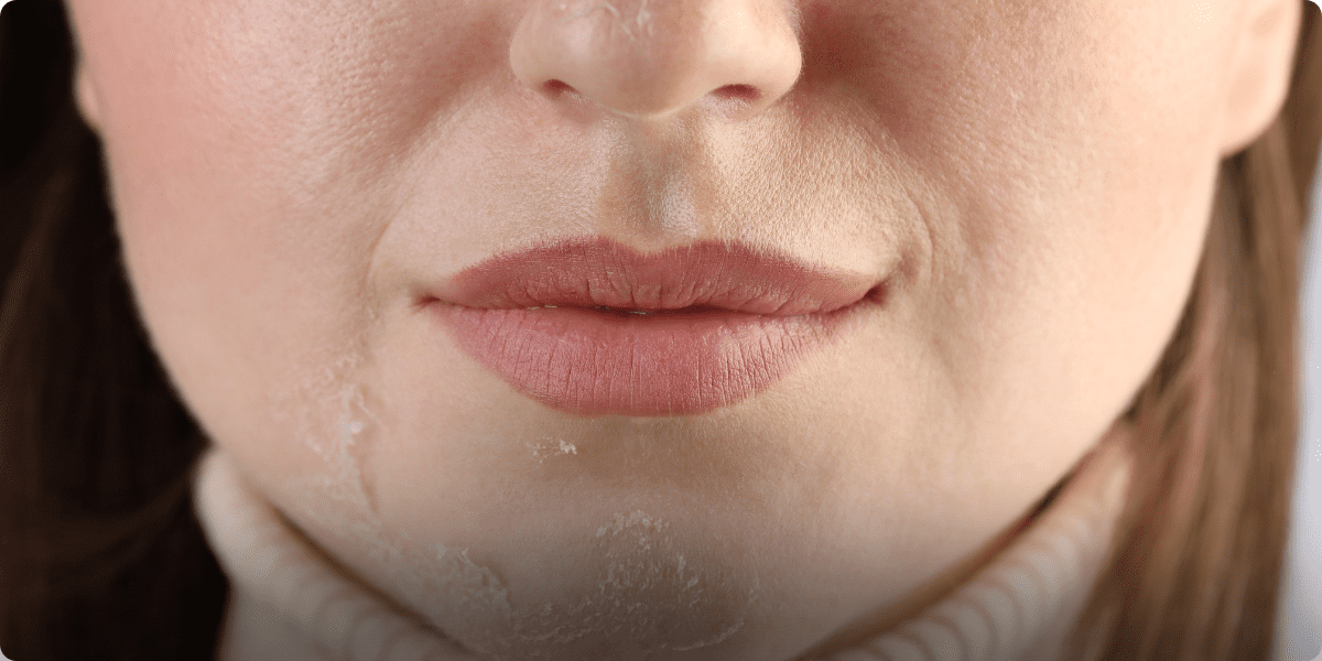 Cuidados com a pele no outono: proteção e hidratação