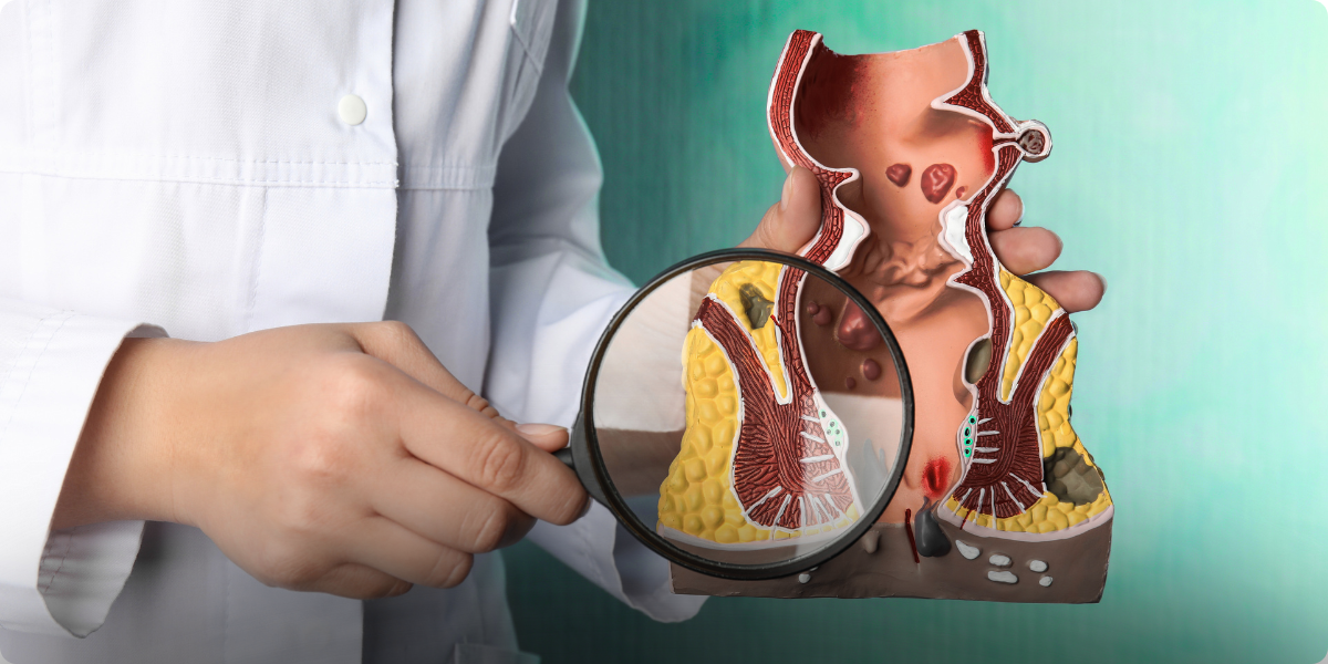 Colonoscopia é prevenção: descubra por quê