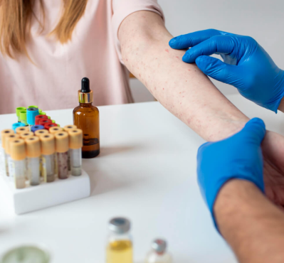 Diagnósticos em Alergia e Imunologia