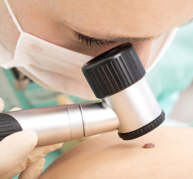 Procedimentos Dermatológicos
