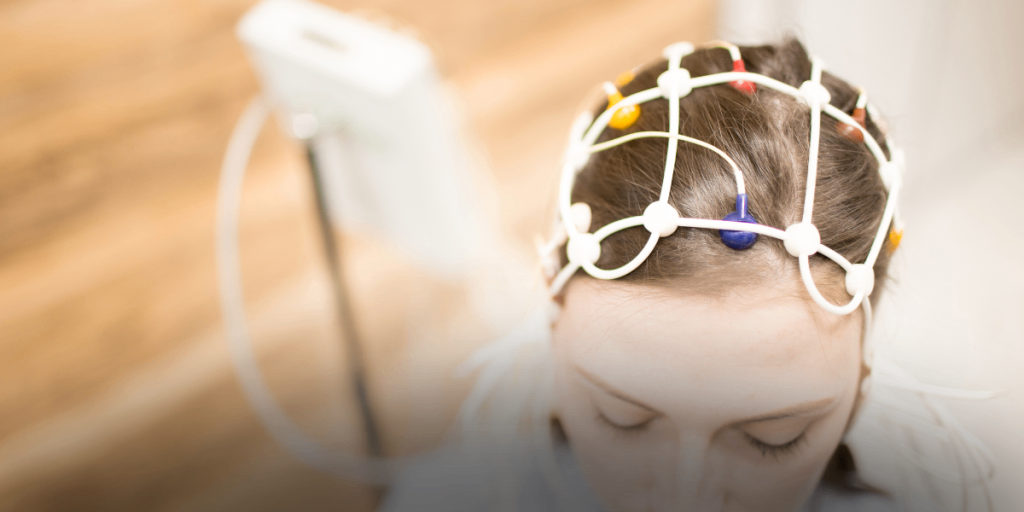 Videoeletroencefalograma (VEEG): o que é, para que serve e quando fazer o exame