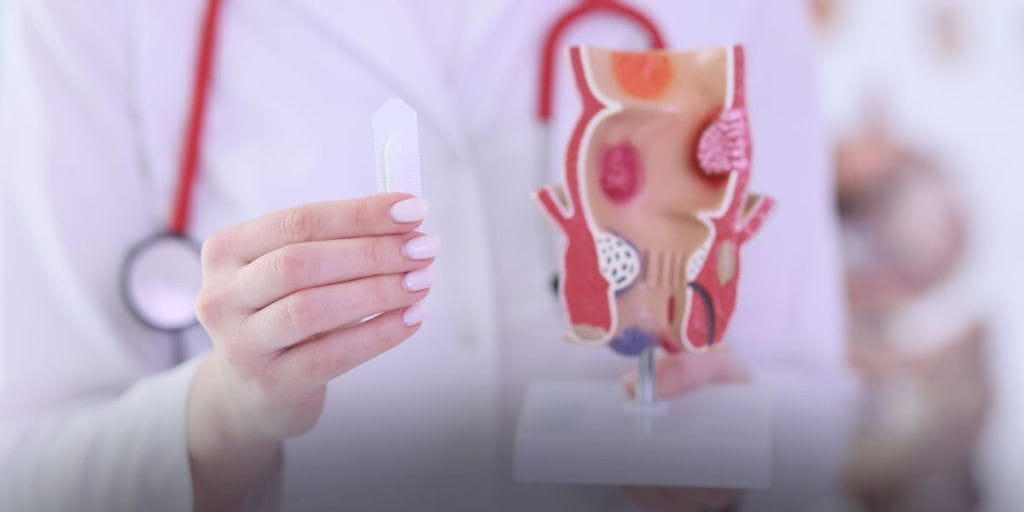 Hemorroidas têm cura? Entenda os sintomas, tratamentos e quando a cirurgia é necessária